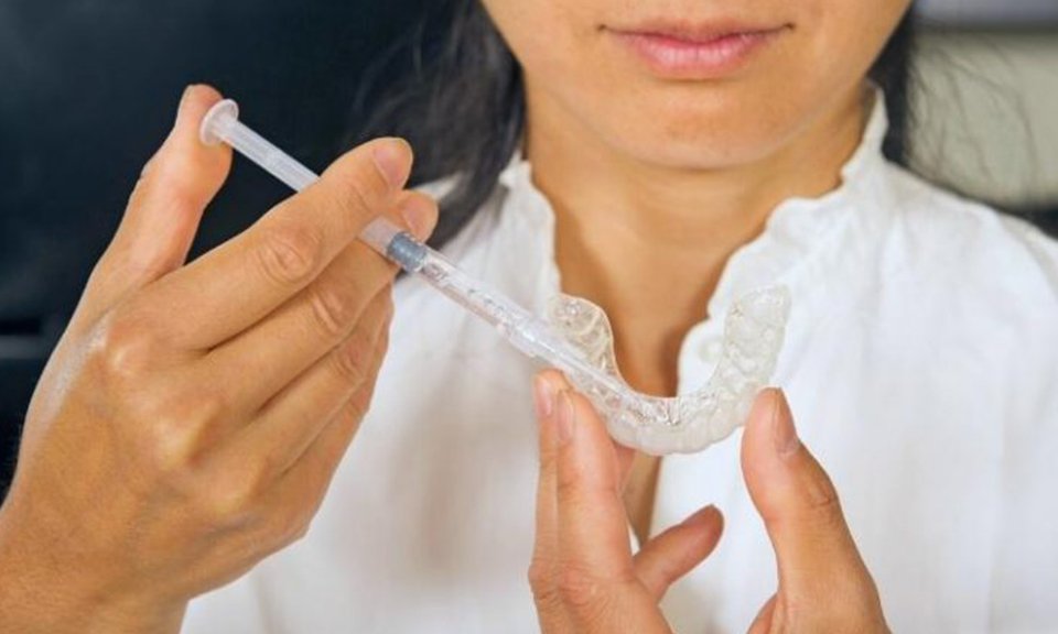 Patient filling a whitening tray with gel from a syringe