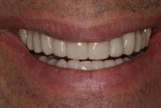 Patient smile after treatment
